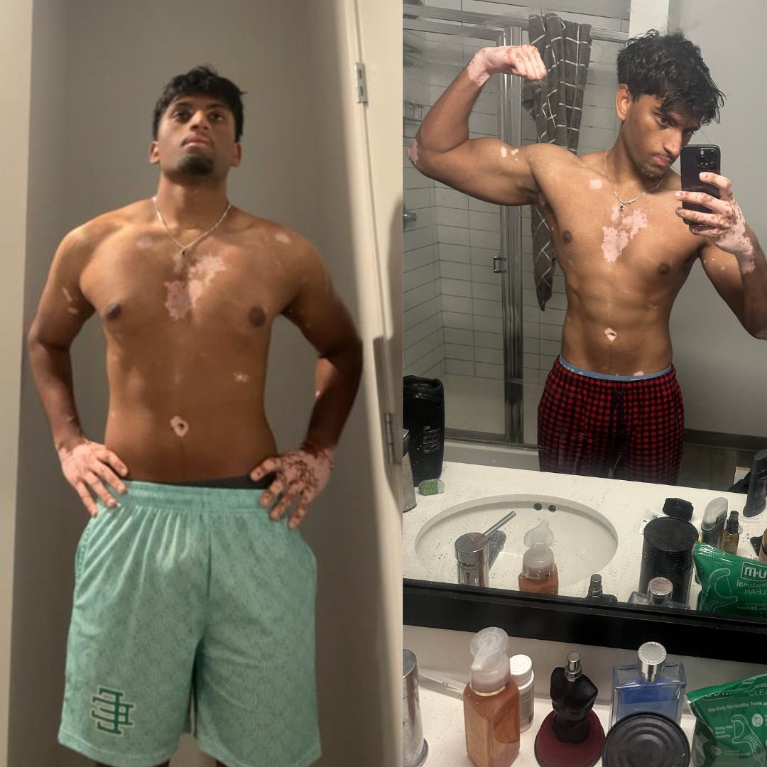 Shrik — Before and After